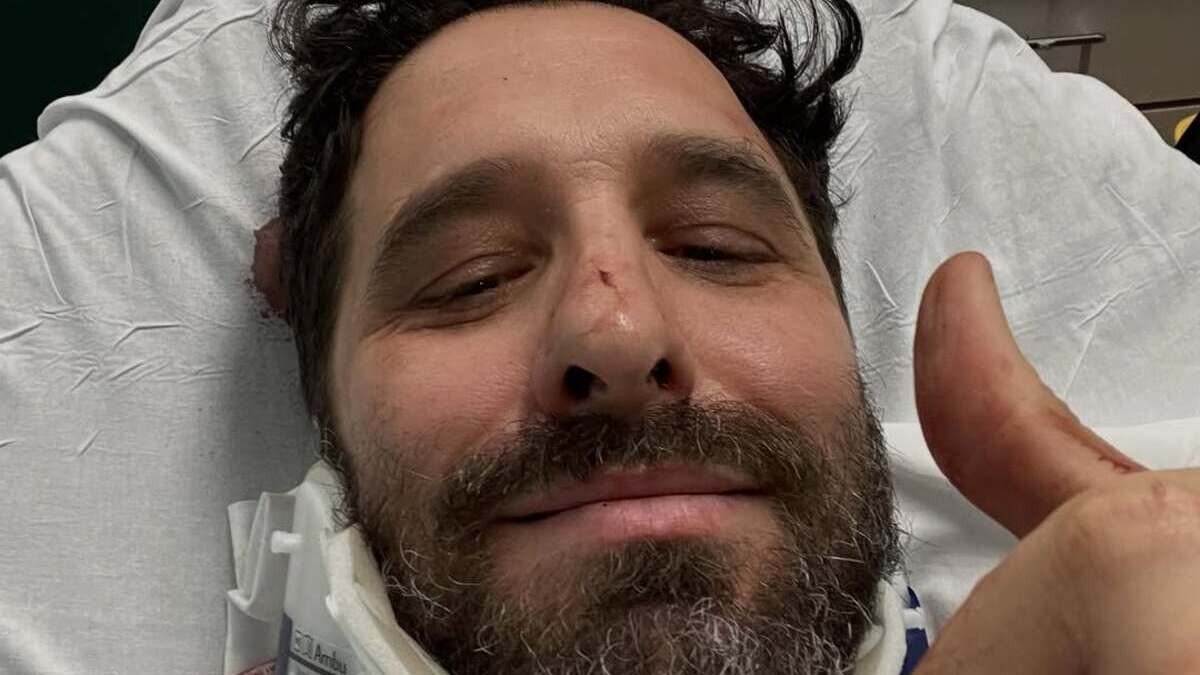 Rafinha Bastos sofre acidente de bicicleta em Nova Iorque