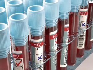 Dois novos casos de possível cura do HIV são anunciados